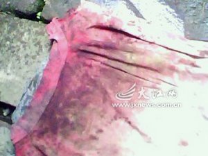 85歲老太家中遭割喉 刀口長約6厘米(組圖)