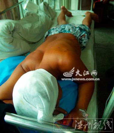 父親唐保國頭部表皮撕裂。