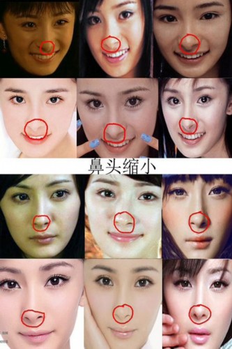 疑似整容部位：內眼角