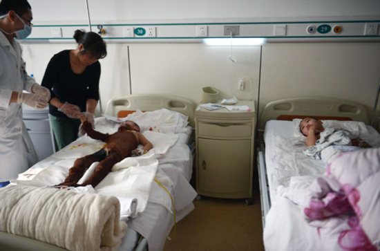 男童模仿灰太狼烤羊，把兩玩伴綁在樹上燒成重傷。