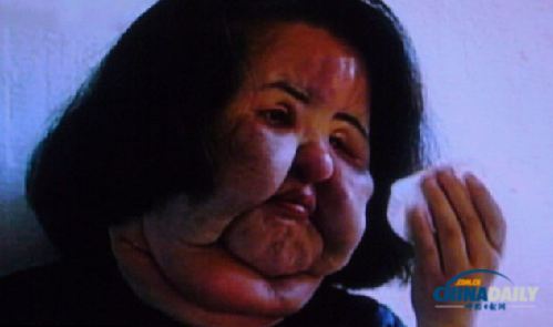 韓國女模整容失敗照片