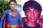 男子整容整成超人 菲律賓男子整容19次把外形整成了