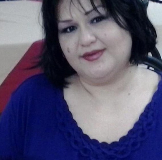 美國(guó)最胖女子梅拉體重544公斤