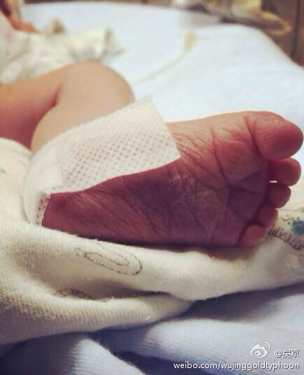 謝楠懷的不是雙胞胎嗎