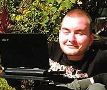 世界首例人體換頭術