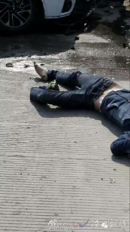 其中一名傷者腿被撞斷