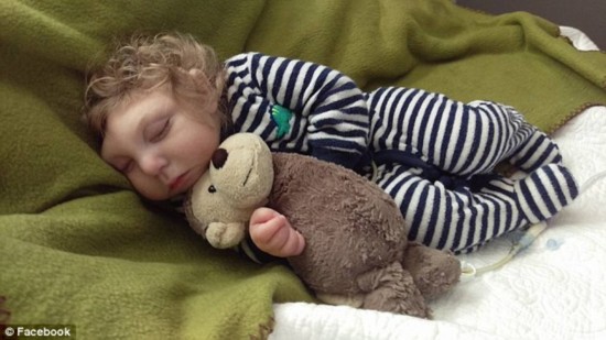 無腦畸形男嬰存活