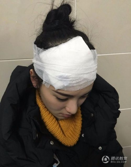 武大校花頭被砸傷