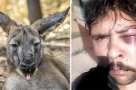 男子打獵遭袋鼠揍下巴骨被撞碎
