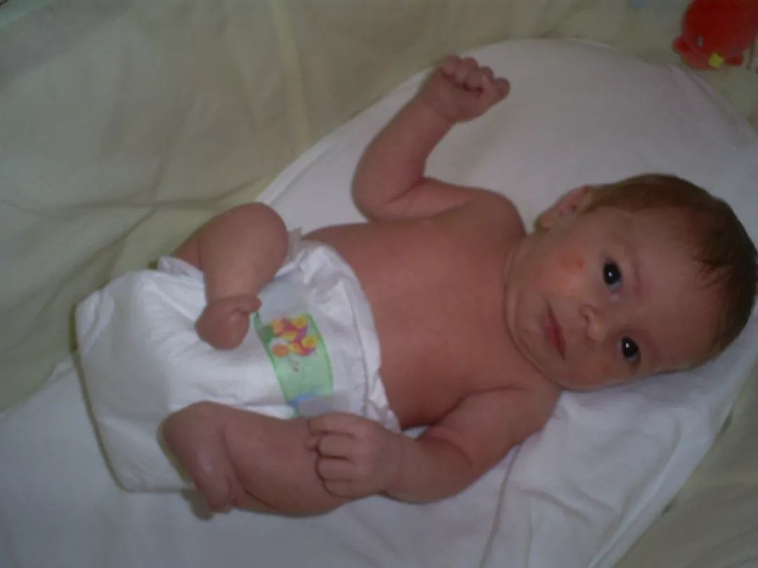 截肢仙女紅遍全球