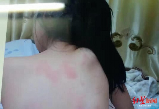 老師打女童致殘疾