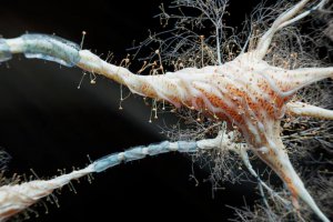 科學家發現治療帕金